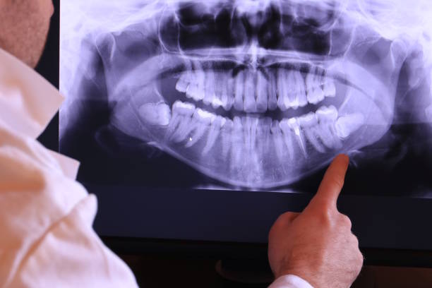 Best Broken or Cracked Tooth Emergency Dentist in Gillette, NJ