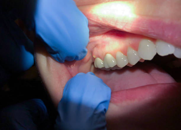 Best Orthodontic Emergency Dentist in Gillette, NJ